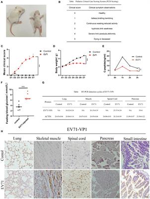 Impaired arginine/ornithine metabolism drives severe HFMD by promoting cytokine storm